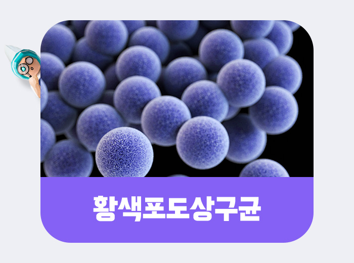 상구균